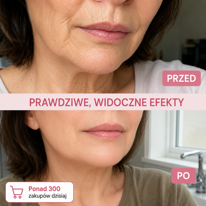 Sztyft Wypełniający Bio-Kolagen PDRN – Efekt Liftingu