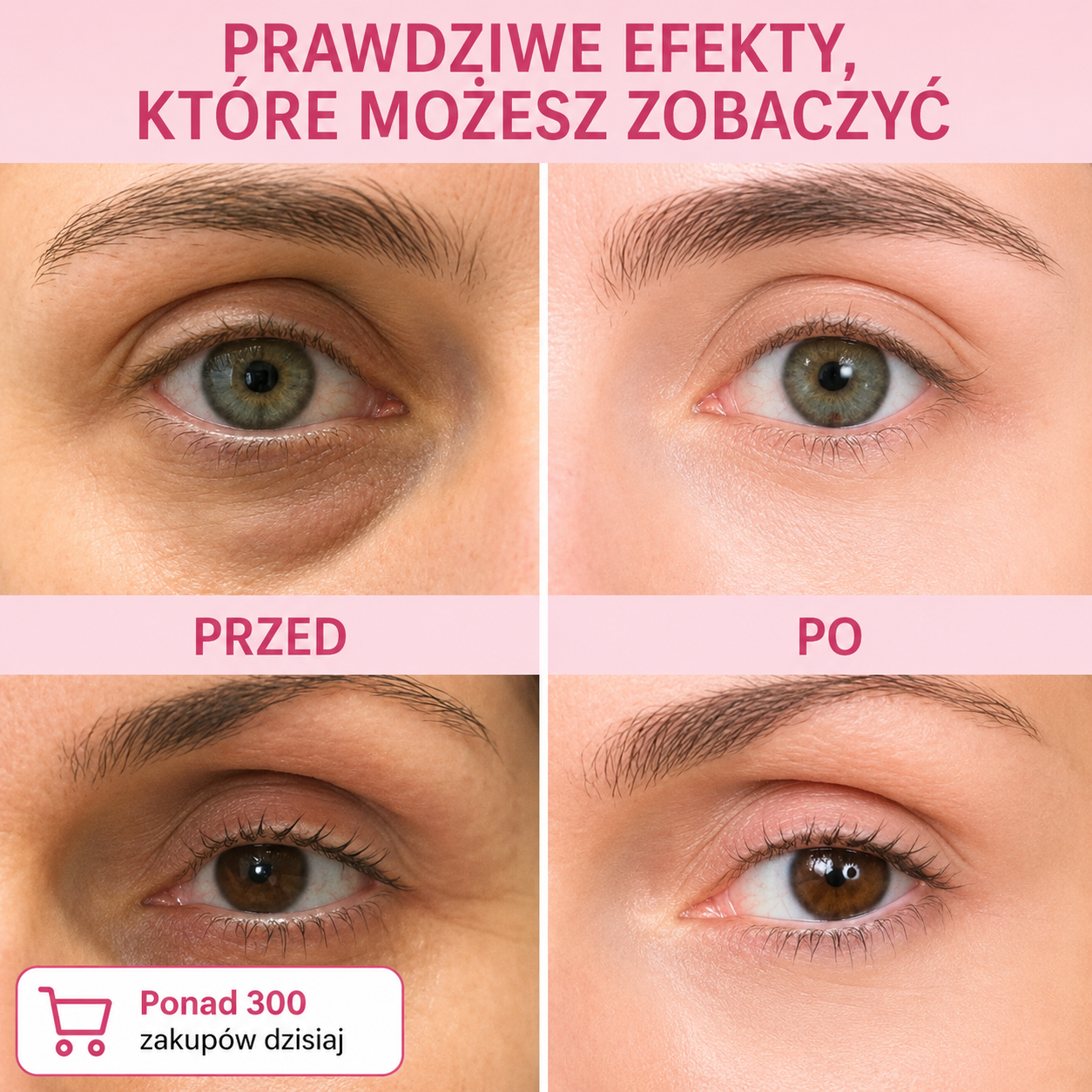 Sztyft Wypełniający Bio-Kolagen PDRN – Efekt Liftingu