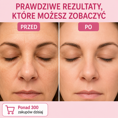 Sztyft Wypełniający Bio-Kolagen PDRN – Efekt Liftingu