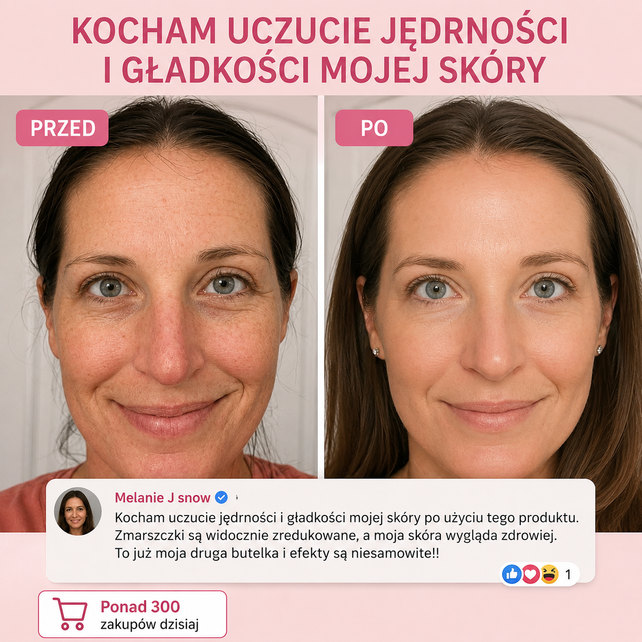 Sztyft Wypełniający Bio-Kolagen PDRN – Efekt Liftingu
